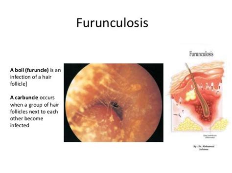 Different ear conditions