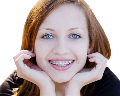 Types of Braces - Kids Dental Online - Plano & Carrollton