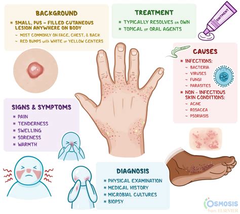 Pustule: What Is It, Causes, Diagnosis, Treatment | Osmosis