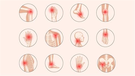 What Causes Sudden Joint Pain? Read Causes and Tips For Management ...