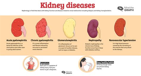 Urinary system diseases: Infographics to understand - Mind the Graph Blog