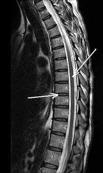 Anatomy of the Thoracic Spine | Spine Anatomy