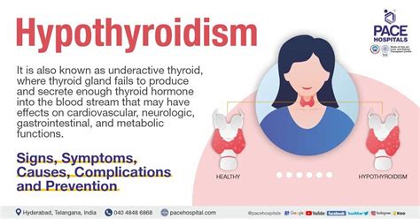 Causes Of Thyroid In Female | edu.svet.gob.gt