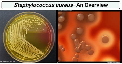 Staphylococcus Aureus