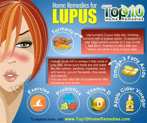 Home Remedies for Lupus | Top 10 Home Remedies