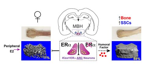 Estrogen Critical to Bone Density – New Research | Orthopedics This Week