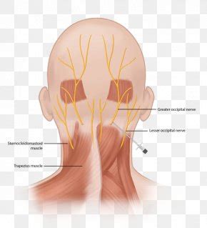 Occipital Neuralgia Greater Occipital Nerve Third Occipital Nerve, PNG ...