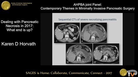 Dealing with pancreatic necrosis in 2017: What end is up? - YouTube