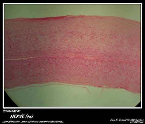 Histology: Nerve Fibers - My Aimst University Lifestyle Blog