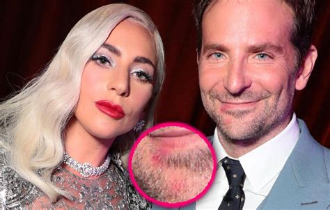 Lady Gaga's Lipstick Seen On Bradley Cooper's Mouth