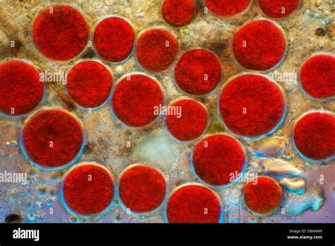 Haematococcus pluvialis (Haematococcus pluvialis), in differential ...