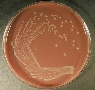 Chocolate Agar: Composition, Preparation, Uses • Microbe Online