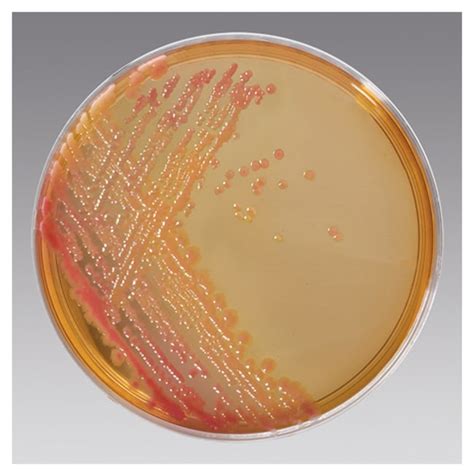 Remel™ Salmonella Shigella Agar (SS Agar)