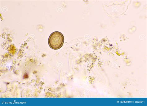 Eggs of Taenia or Tapeworm in Human Stool Stock Photo - Image of ...