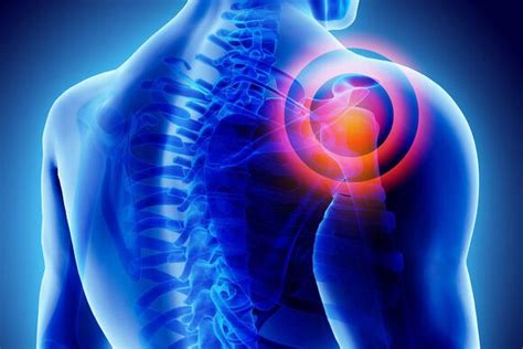 Frozen shoulder non surgical treatment in delhi | Dr. Amod Manocha