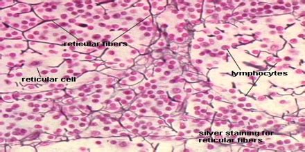 Reticular Connective Tissue - Assignment Point