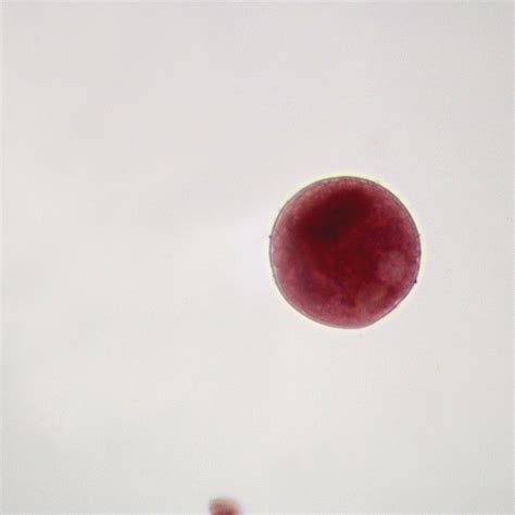 Balantidium coli Cysts, smear Microscope Slide | Carolina.com