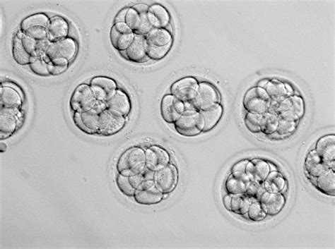 Frozen Embryo Transfer Perth - FET - Fertility North