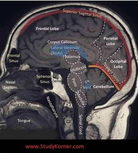 Well labelled MRI of the brain | Medical knowledge, Radiology ...