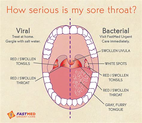 Sore Throat Treatment