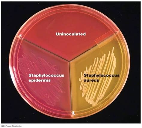 Mannitol Salt Agar: Principle, Uses, and Results • Microbe Online