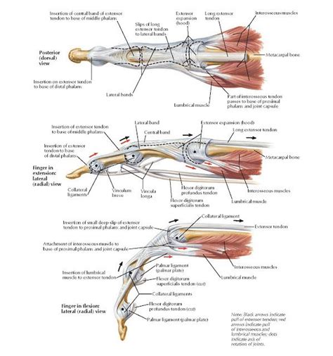 Finger Flexor Tendon Injuries