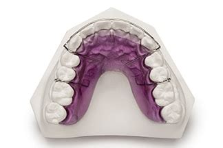 Orthodontics Laboratory - Retainer and Finishing | DDS Lab