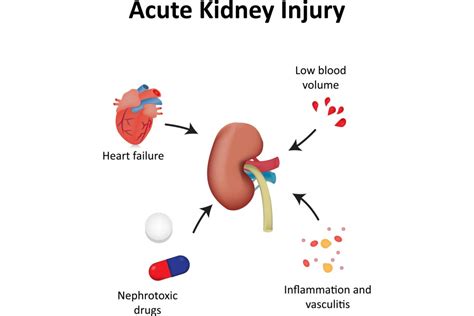 Acute Kidney Injury in El Paso, TX