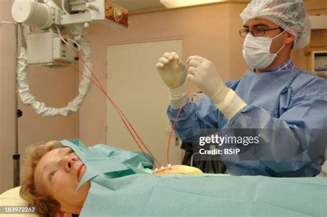 33 Brachytherapy Stock Photos, High-Res Pictures, and Images - Getty Images