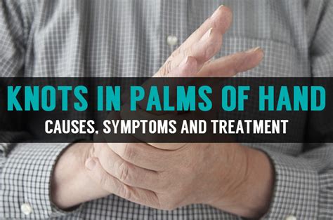 Knots and Lump in Palm of Hands | Symptoms & Home Treatment