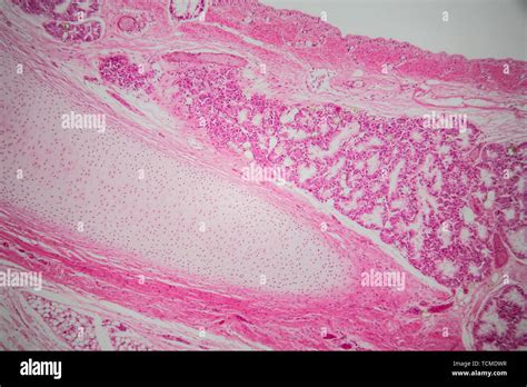 Tracheal Cartilage Histology