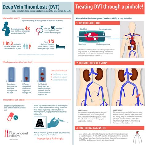 Deep Vein Thrombosis Treatment in Denver, CO | MIPS Vein Center