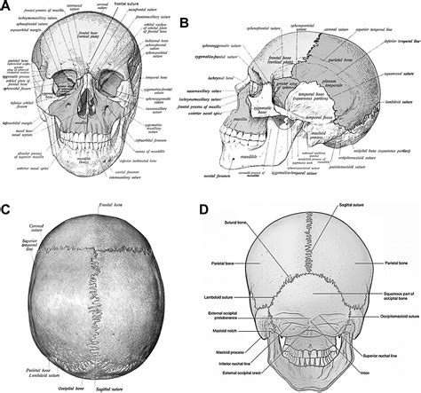 Cranial suture headache: An extracranial head pain syndrome originating ...