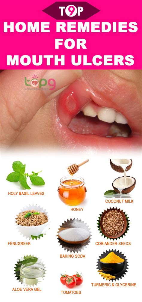 Home Remedies For Canker Sore | Home and Garden Reference