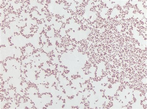 Enterobacter Aerogenes Gram Stain