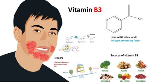 Vitamin Deficiency Rash