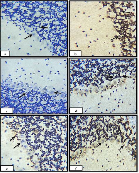 Photomicrograph of TNF-a immunohistochemical staining in the cerebellum ...