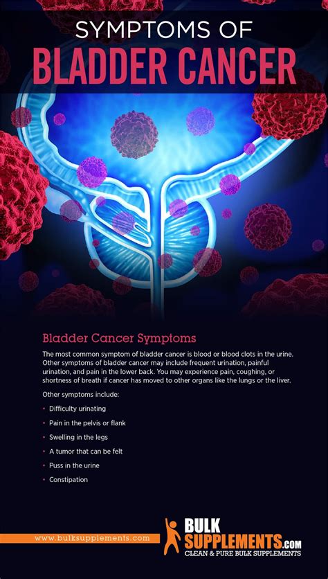 Bladder Cancer: Symptoms, Causes & Treatment