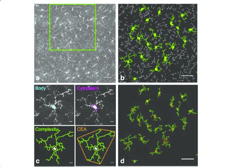 The characterization of microglial cells by morphological criteria. a ...