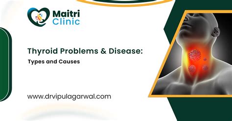 Thyroid Problems And Disease: Types and Causes By Dr. Vipul Agarwal