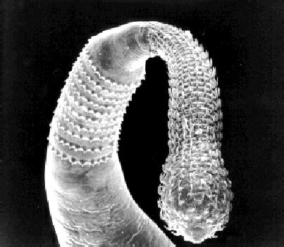 Acanthocephala | Parasitic worms, Invertebrates, Worms