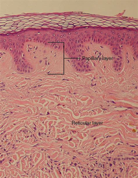 Dermis | Biology for Majors II