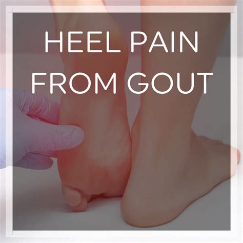 Can Uric Acid Cause Heel Pain? Signs of Gout in the Heel | Heel That Pain