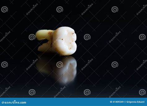 Broken Tooth After Extraction Stock Photo - Image: 41409349