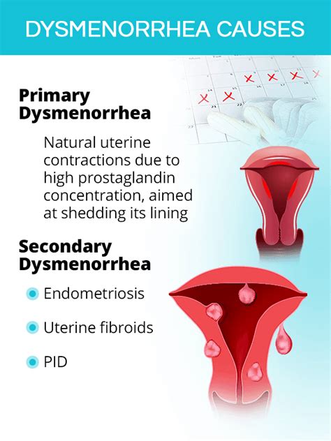 Dysmenorrhea: Menstrual Cramps | SheCares