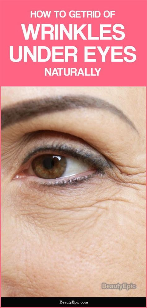 How to Get Rid of Under Eye Wrinkles Naturally | Eye wrinkle, Under eye ...