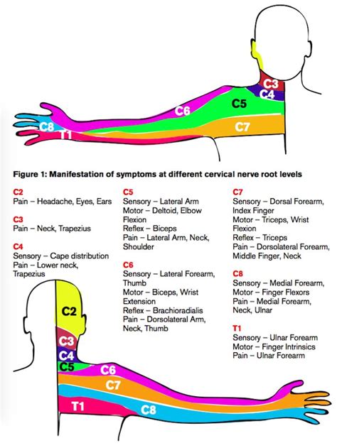 Cervical Radiculopathy - Emergency Physicians Monthly in 2020 ...