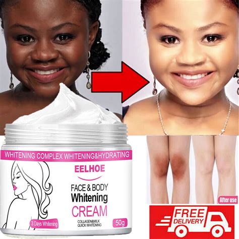 Unveiling the Truth About Skin Bleaching Products: Separating Fact from ...