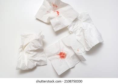 Blood On Used Toilet Paper On Stock Photo 2108750330 | Shutterstock