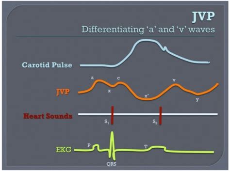 Jugular Venous Pressure Waveform